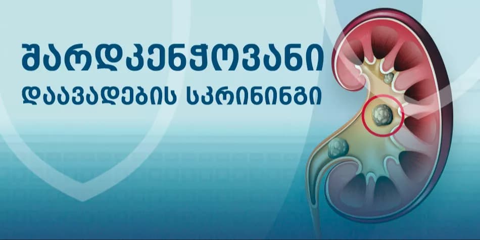 შარდკენჭოვანი დაავადებების სკრინინგი და სწრაფი დიაგნოსტიკა აკადემიკოს ვახტან ბოჭორიშვილის კლინიკაში