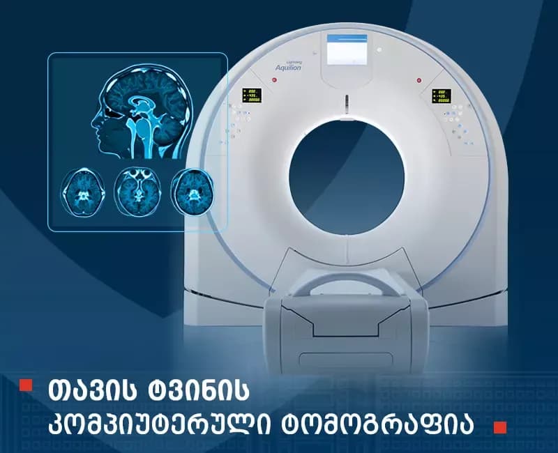 Brain computed tomography (CT)