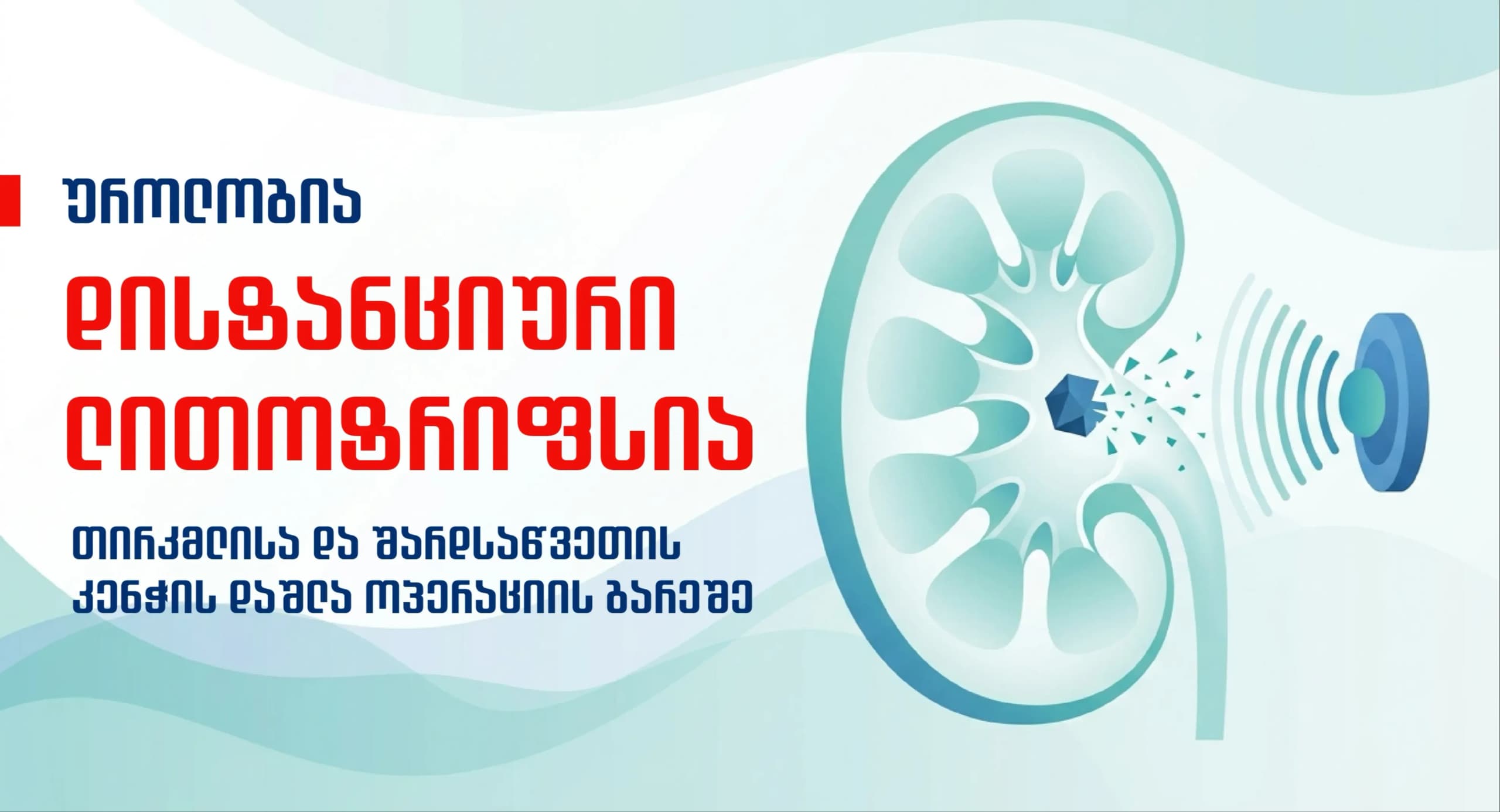 distanciuri-litotripsia-tirkmlidan-an-shardsawvetidan-kenchis-amogeba