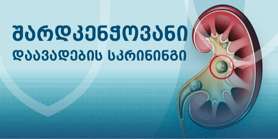 შარდკენჭოვანი დაავადებების სკრინინგი და სწრაფი დიაგნოსტიკა აკადემიკოს ვახტან ბოჭორიშვილის კლინიკაში