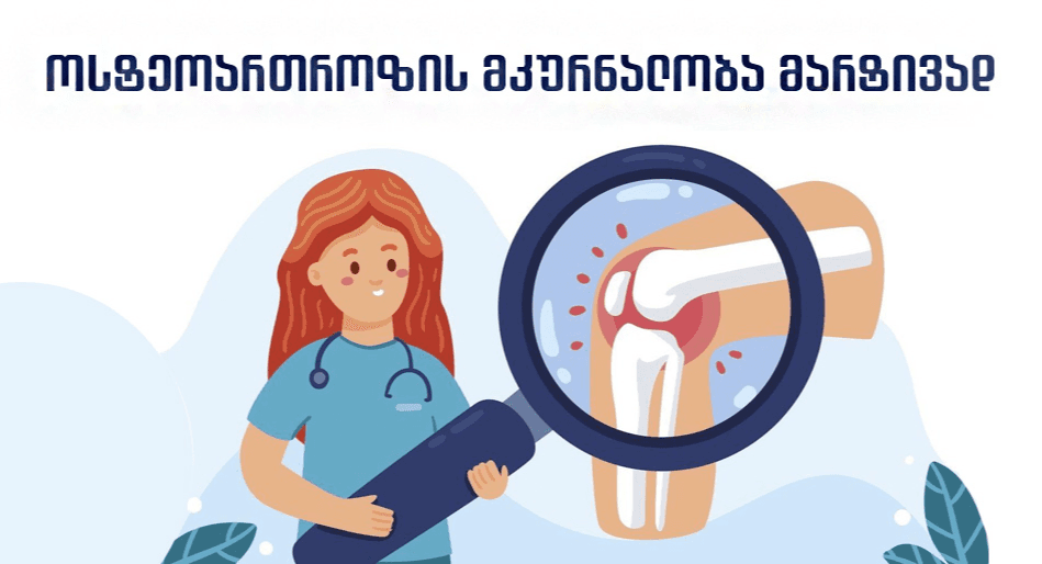saxsrebis-tkivili-da-mkrnaloba-osteoartrozis-mkurnaloba