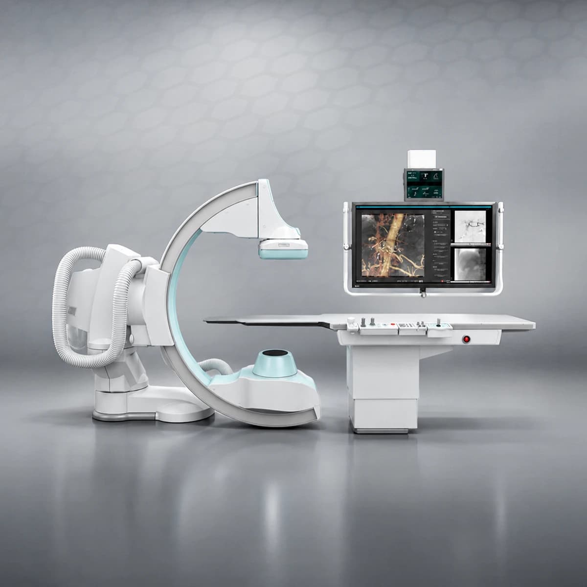 Angiograph-SHIMADZU-Trinias-C16s-angiografi-katlabi-kardiologia-axali-teqnologia