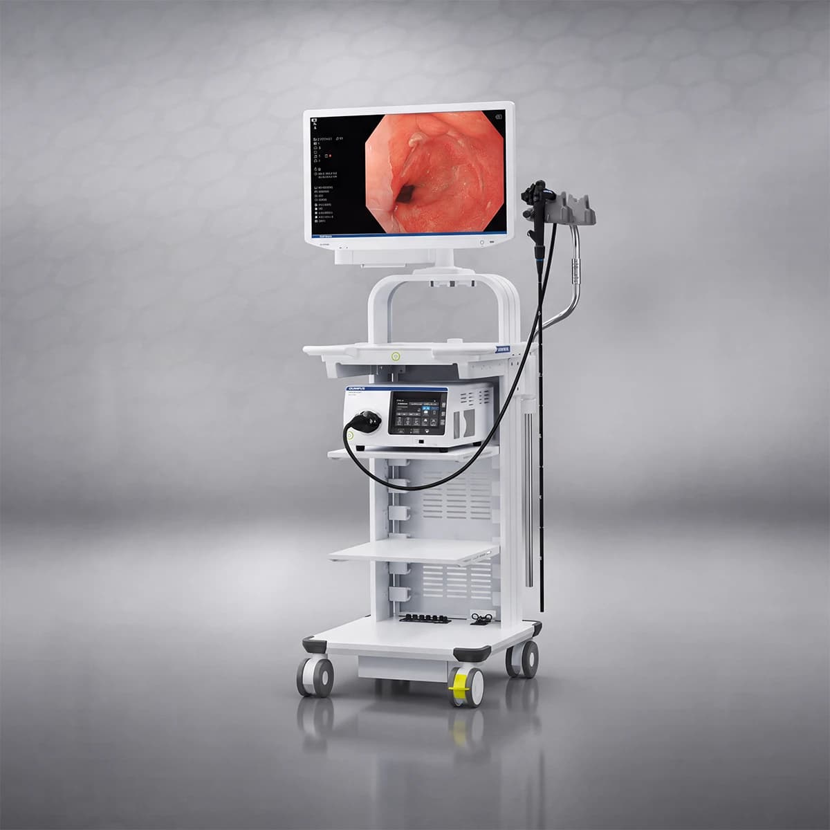endoskopiis-aparati-olympus-evis-x1-cv-1500