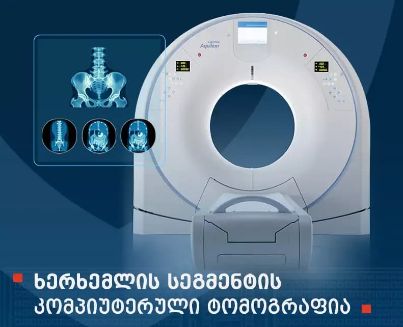 Computed tomography of a spinal segment (CT)