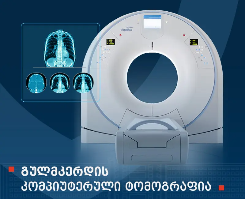 გულმკერდის კომპიუტერული ტომოგრაფია (CT)
