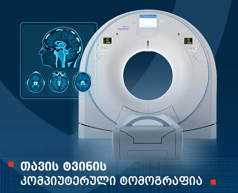 თავის ტვინის კომპიუტერული ტომოგრაფია (CT)