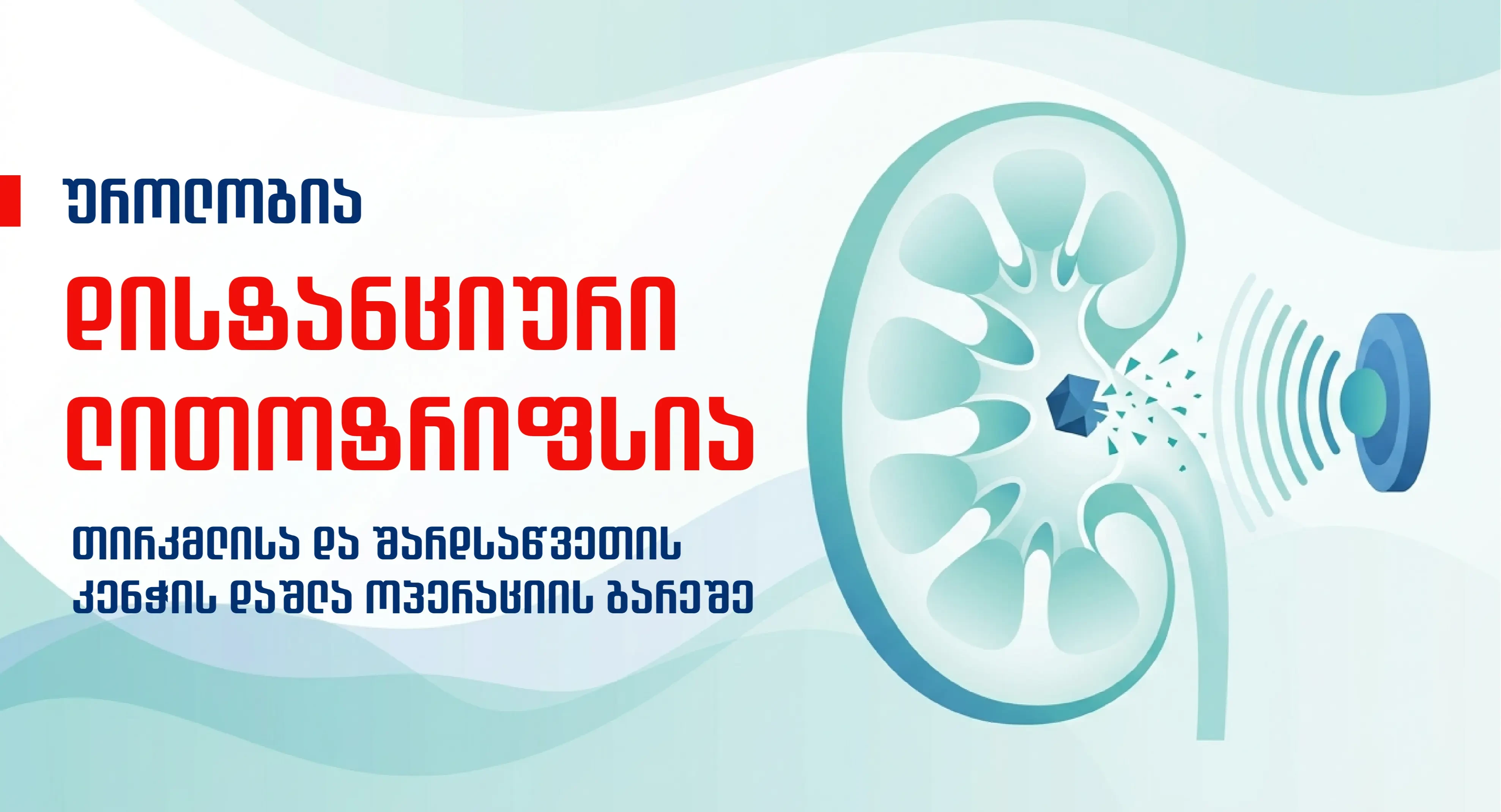 distanciuri-litotripsia-tirkmlidan-an-shardsawvetidan-kenchis-amogeba