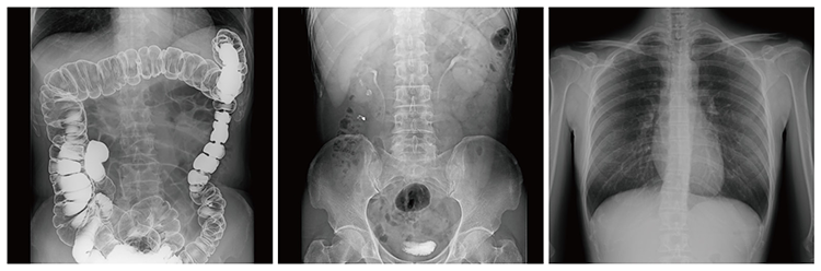 სკანერი სურათი