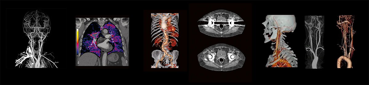 gamosaxuleba-ct-content