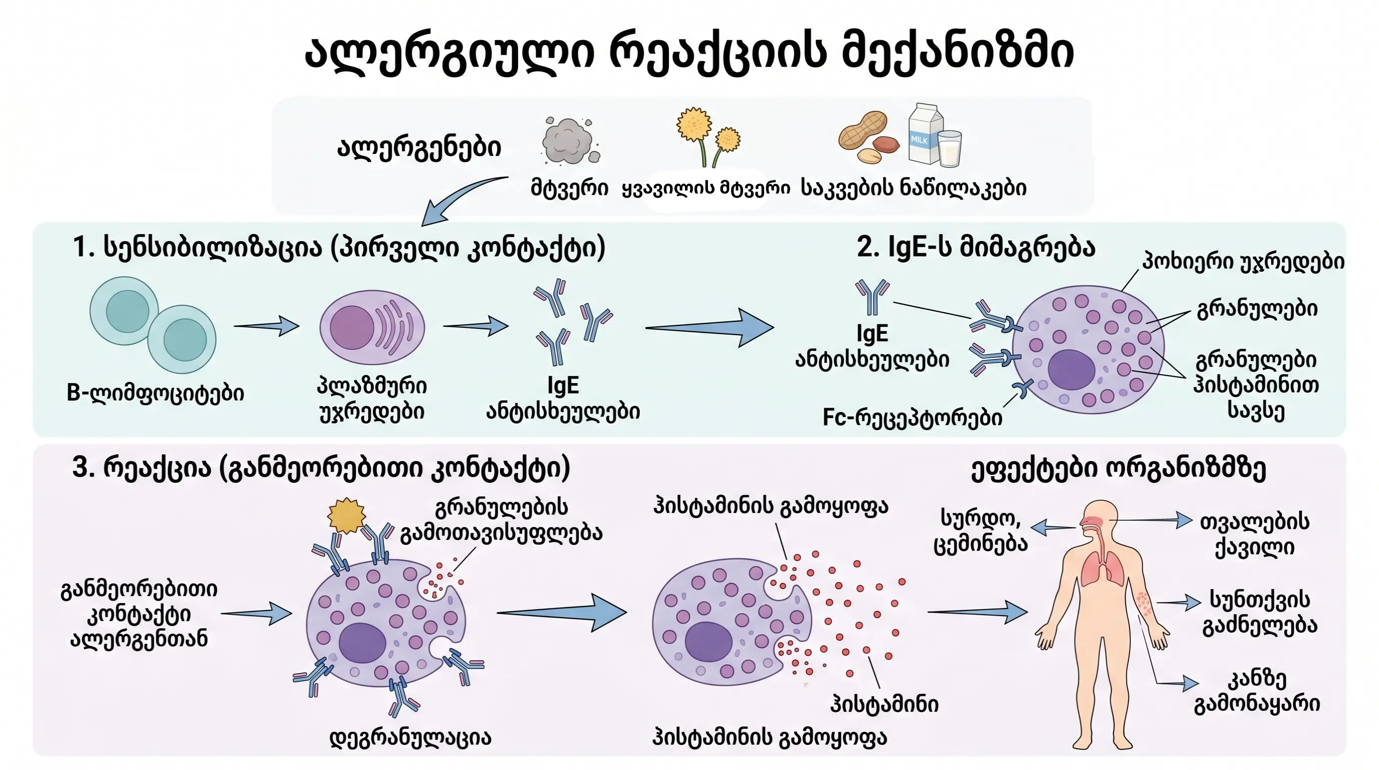 Alergiuli-reaqciiis-meqanizmebi-ru