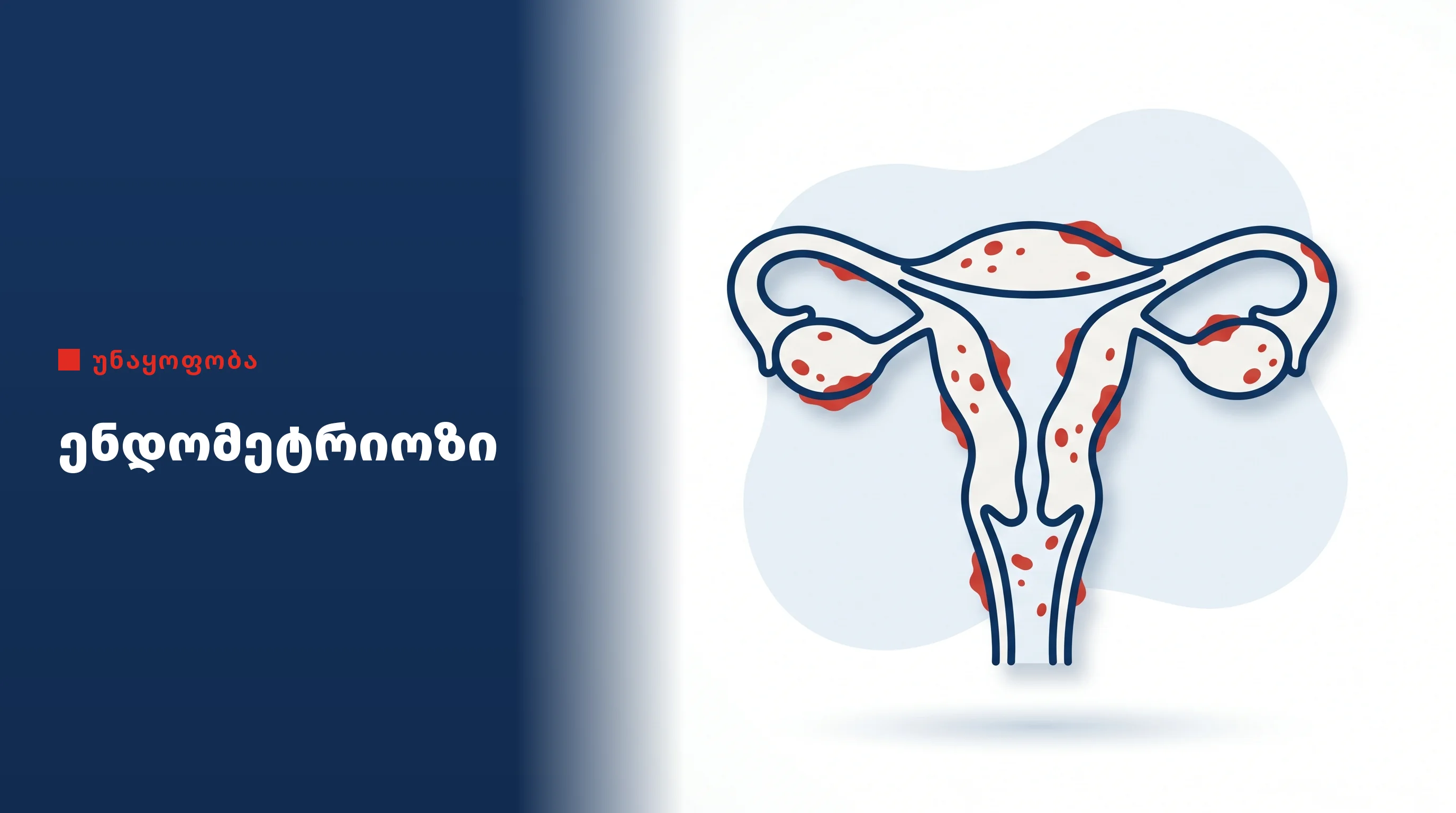 endometriozi