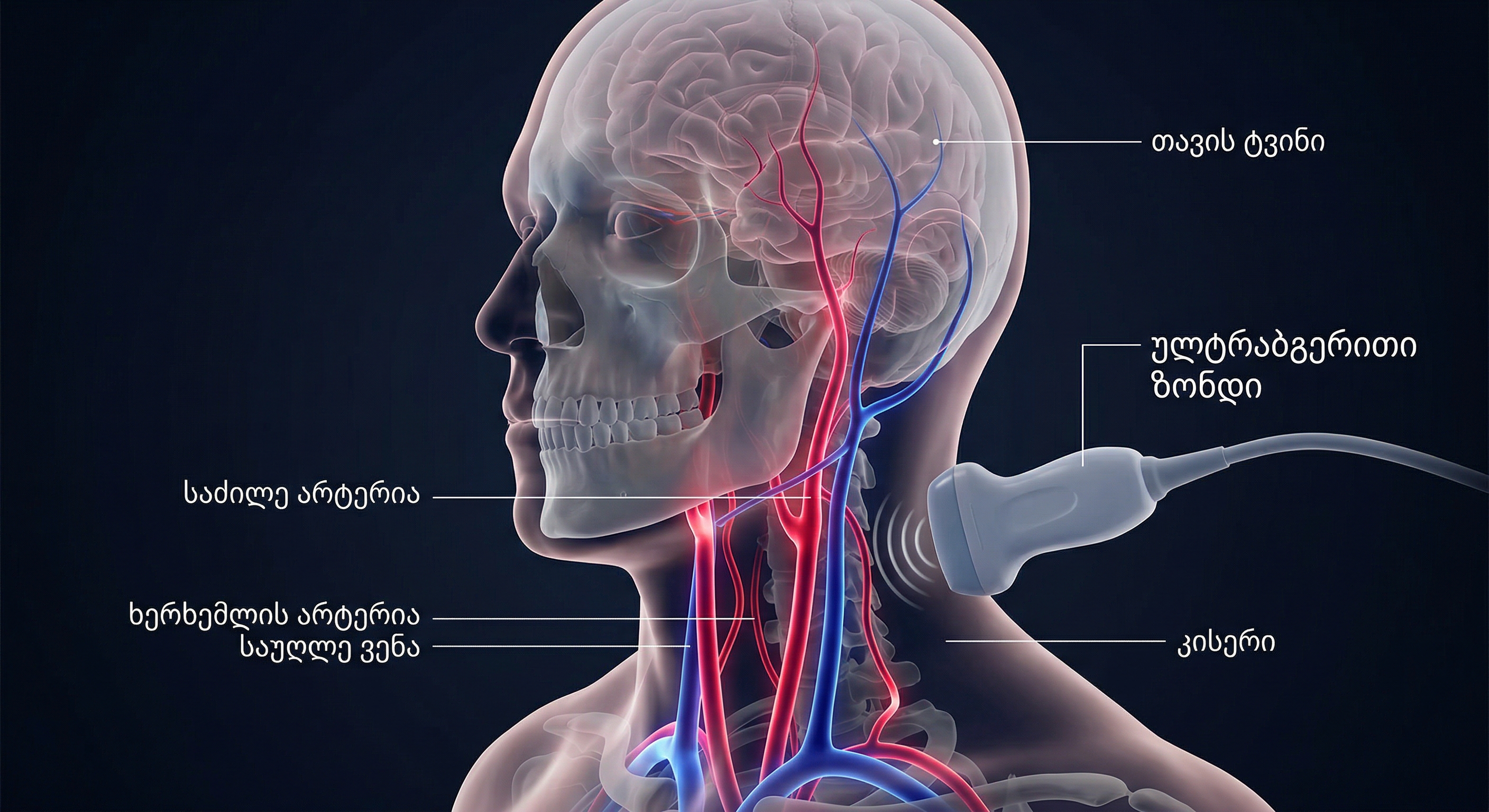 eqstrakranialuri-sisxldzargvebis-doplerografia
