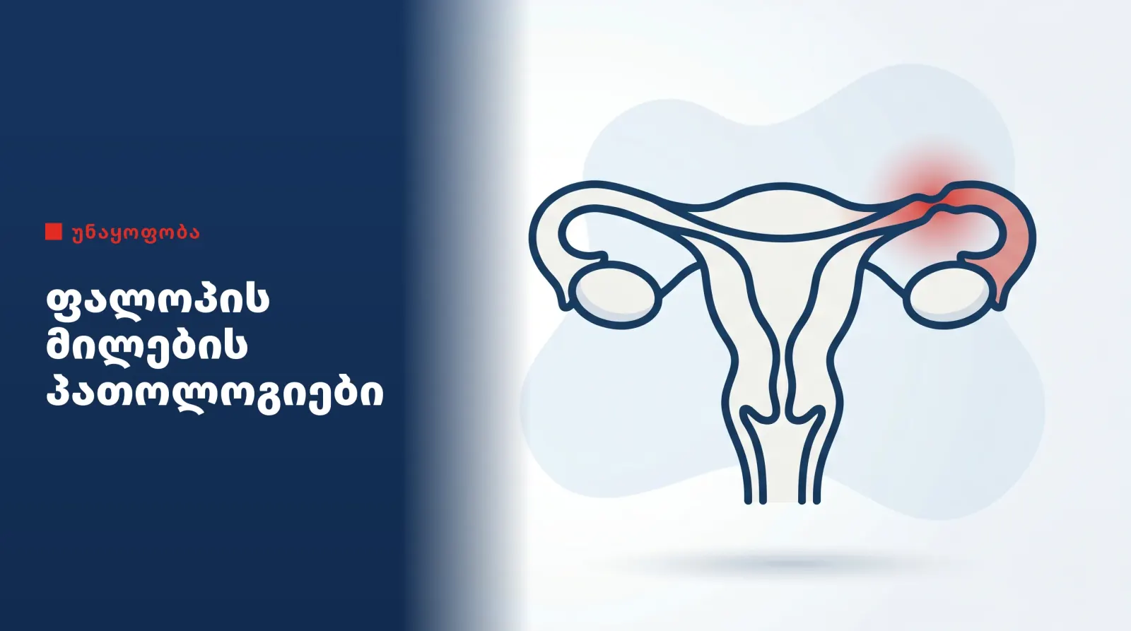 fallopian-mile-pathology
