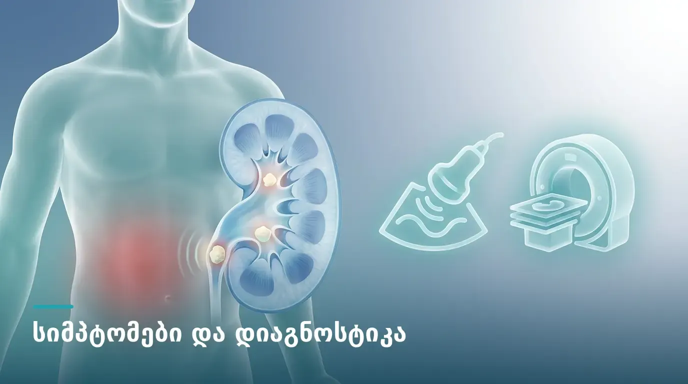 simtomebi-da-diagnostika-tirkmelshi-kenchis-arsebobisasa