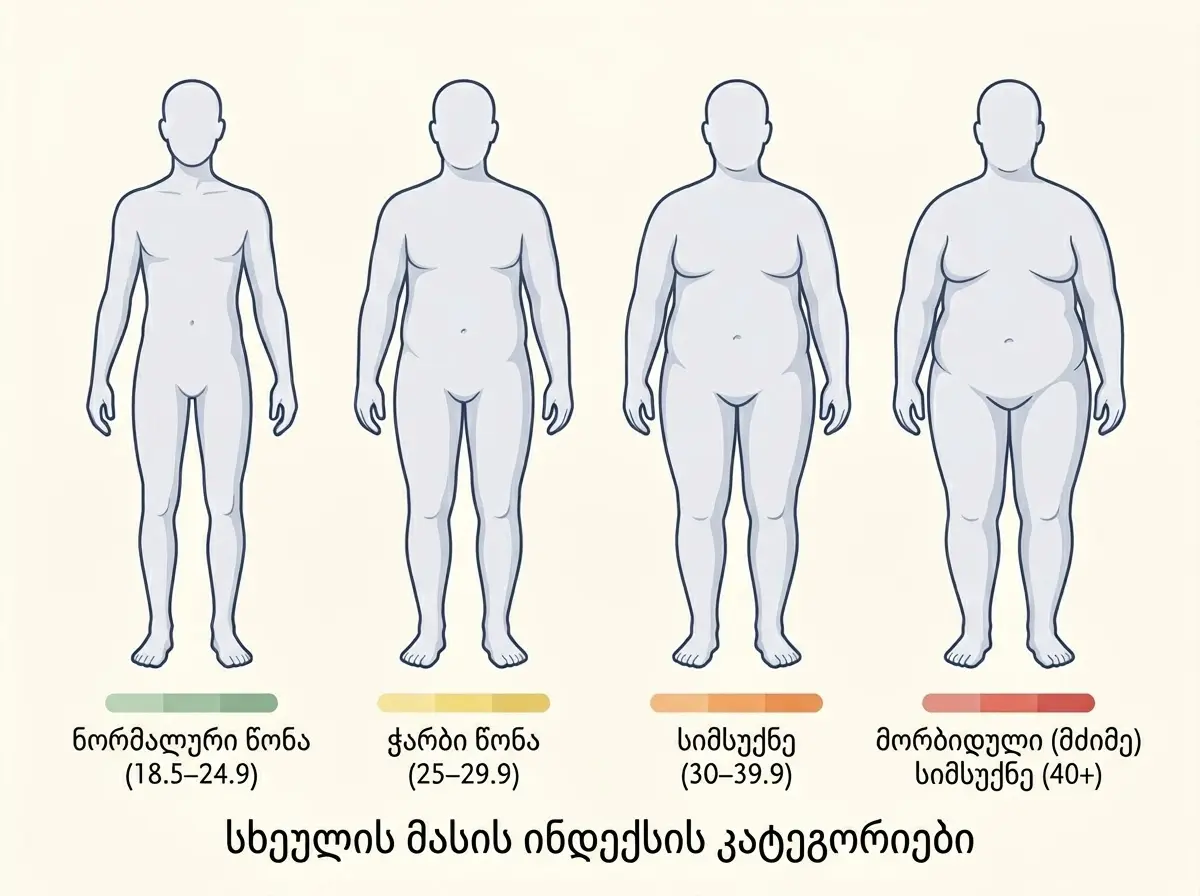 vis-chirdeba-bariatria